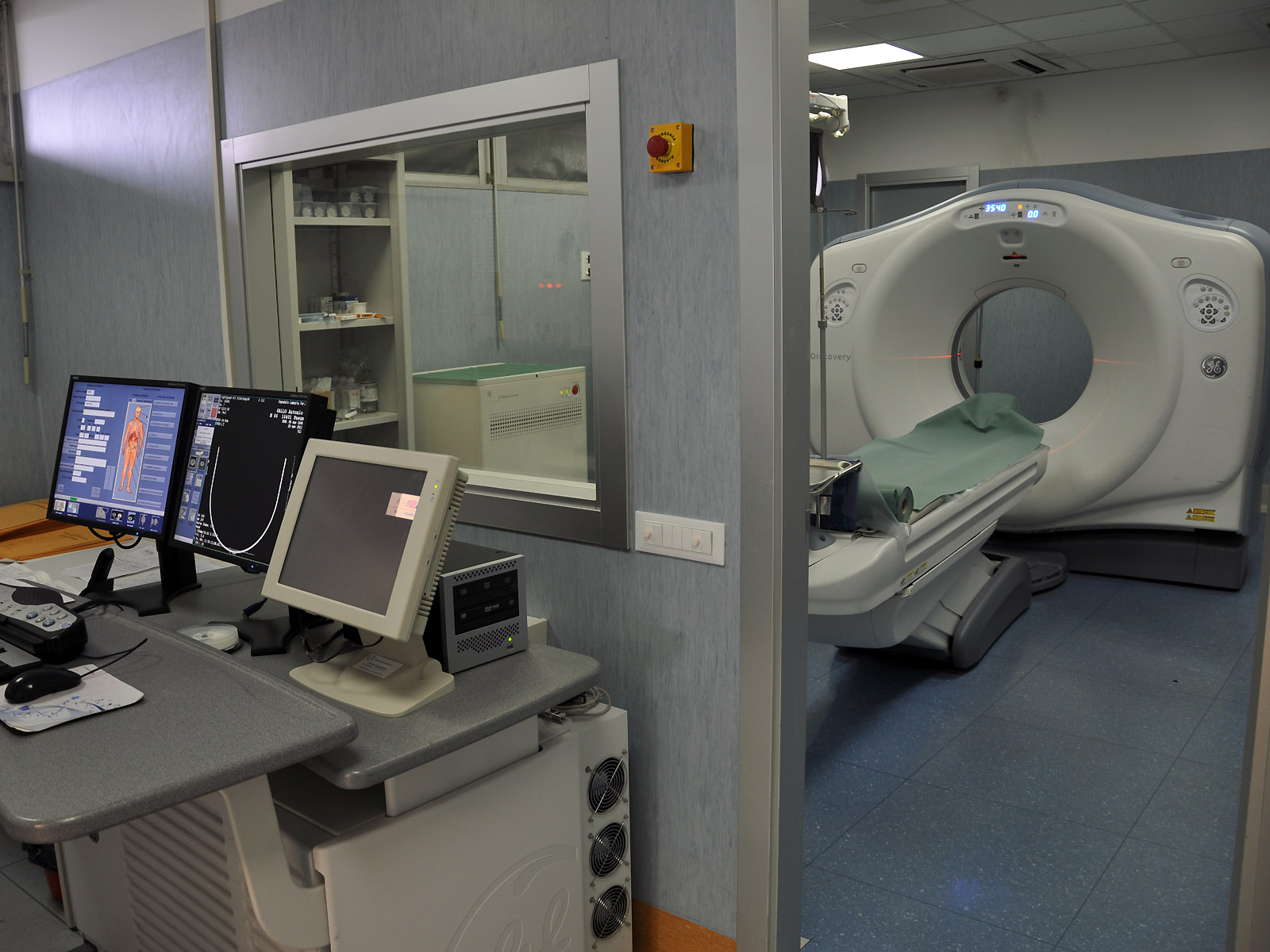 OSPEDALE DI LOCRI: ANCORA PROBLEMI, RADIOLOGIA AL COLLASSO - 